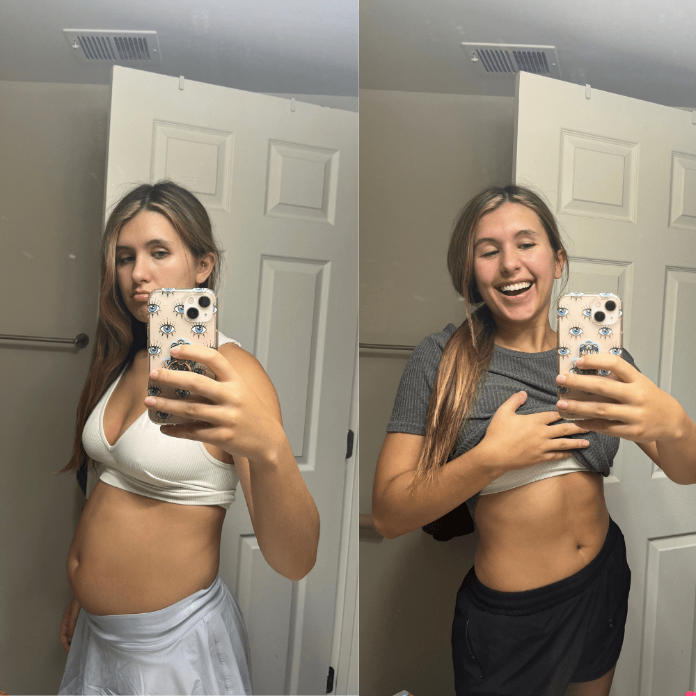 Bloat Control - Ovira