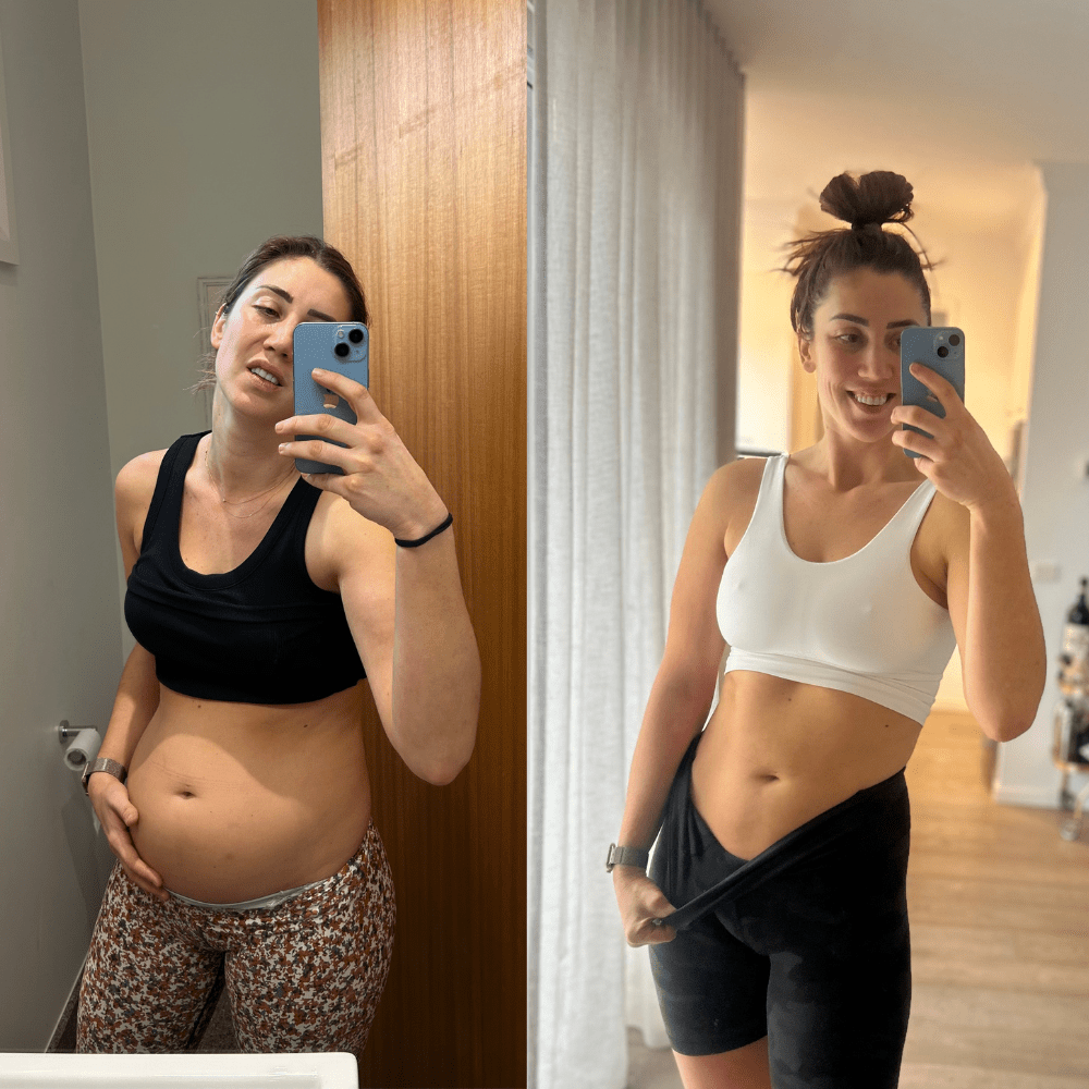 Bloat Control - Ovira